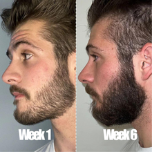 Load image into Gallery viewer, Beard Growth Kit

